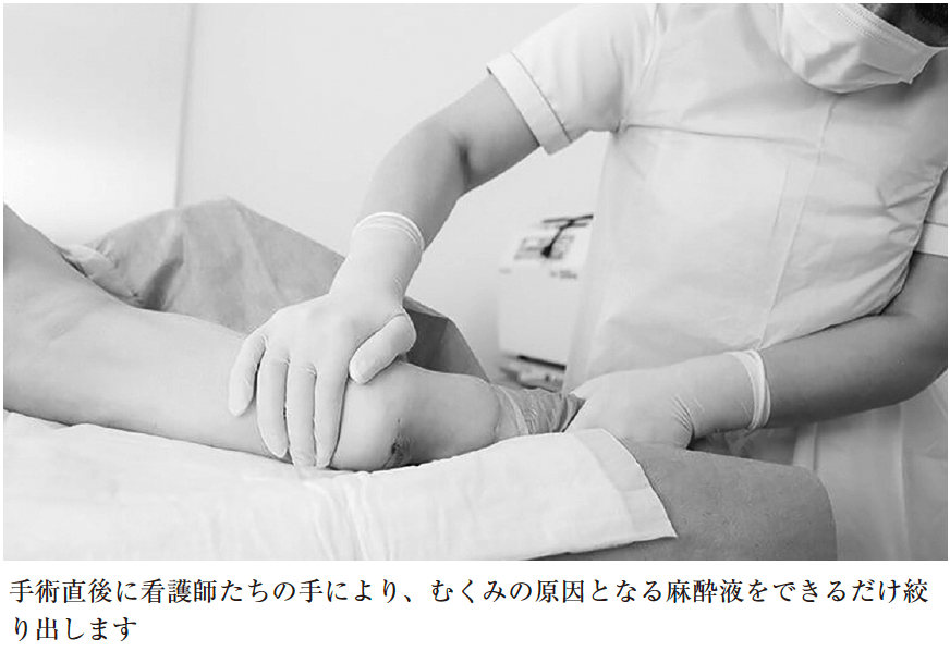 ③麻酔液をできるだけ絞り出す(1回目)