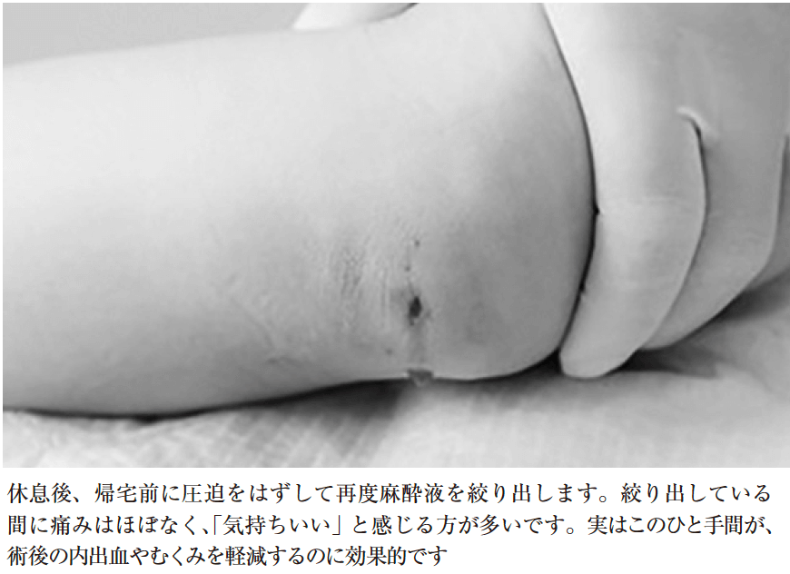 ⑤麻酔液を極限まで絞り出す(2回目)