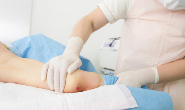 軽くて短いダウンタイム