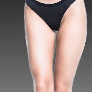 太ももの脂肪吸引のイメージ